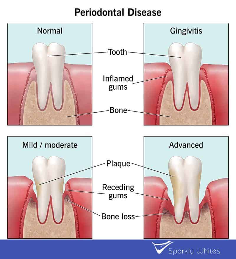 If Your Gums Could Talk, What Would They Say About Your Health Basildon?