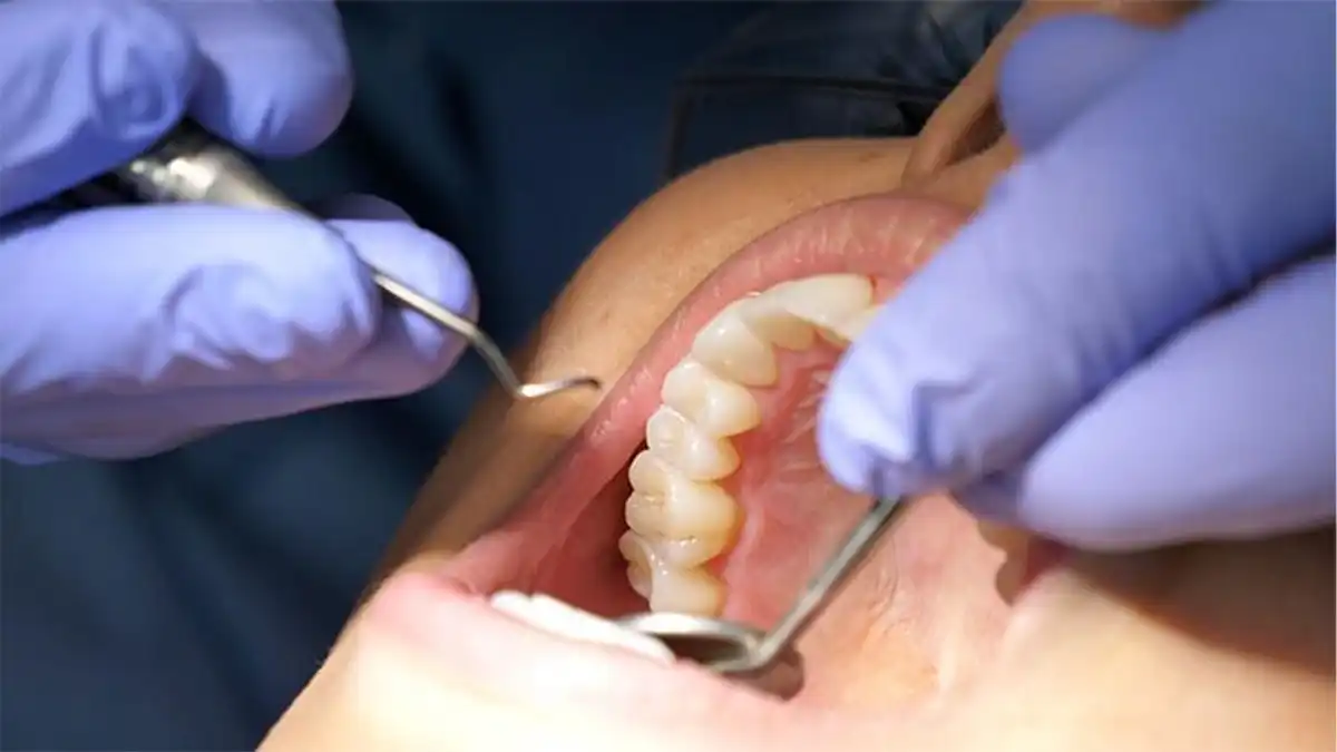 What's The Actual Difference Between Laser and Tray Teeth Whitening—And Why Should You Give a Floss Basildon?